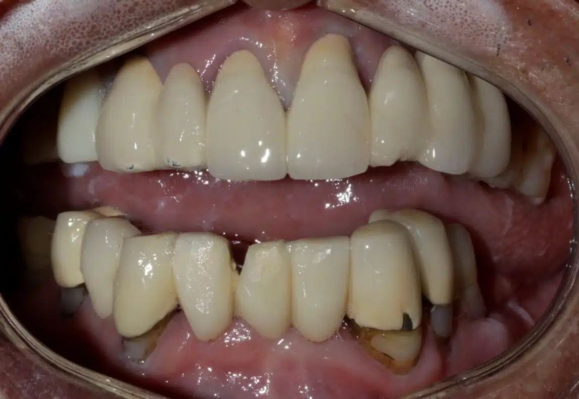 Before image