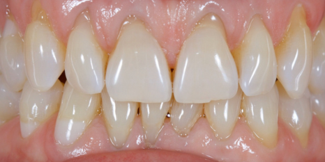 Before image
