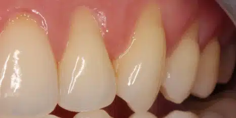 Before image