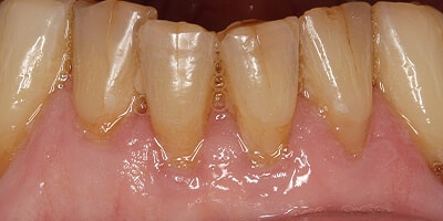 Before image