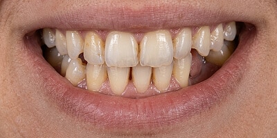 Before image