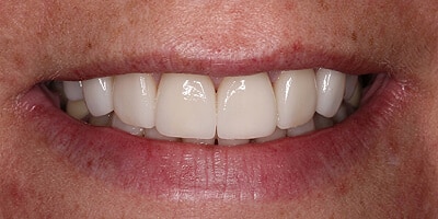 After image